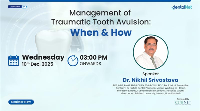 Management of Traumatic Tooth Avulsion: When & How?